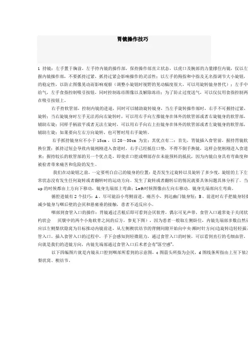 胃镜操作技巧要点