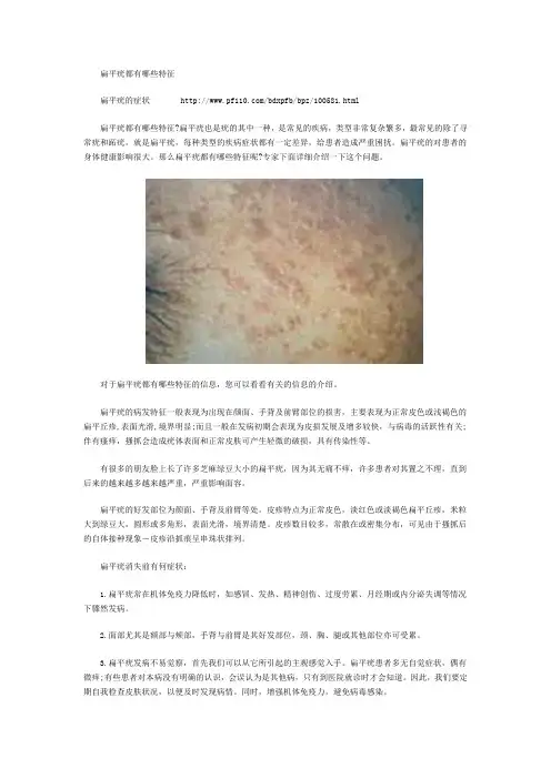 扁平疣都有哪些特征