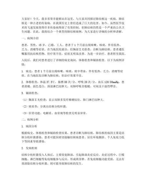 肺结核病例演讲稿范文
