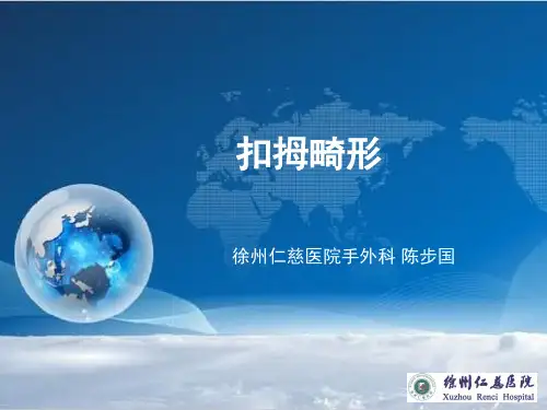 扣拇畸形