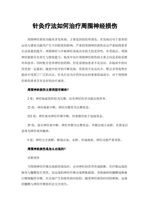 针灸疗法如何治疗周围神经损伤