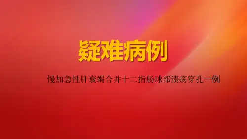 慢加急性肝衰竭合并十二指肠球部溃疡穿孔一例