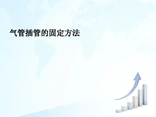 气管插管的固定方法 
