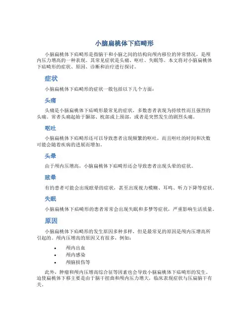 小脑扁桃体下疝畸形