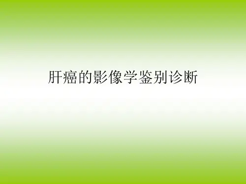肝癌影像学鉴别诊断