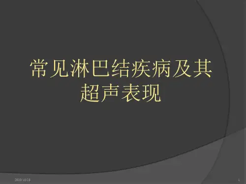 常见淋巴结疾病及其超声表现 ppt课件
