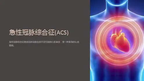 急性冠脉综合征(acute-coronary-syndrome-ACS)