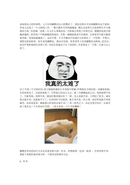 腱鞘炎这样治疗才有效