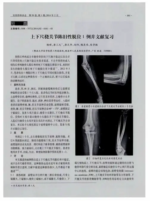 上下尺桡关节陈旧性脱位1例并文献复习