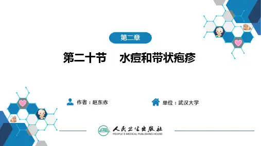 小儿传染病学(第5版)PPT课件 水痘和带状疱疹