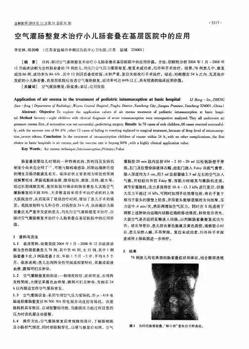 空气灌肠整复术治疗小儿肠套叠在基层医院中的应用