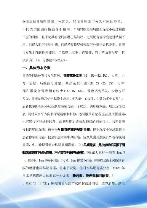 胃癌分型