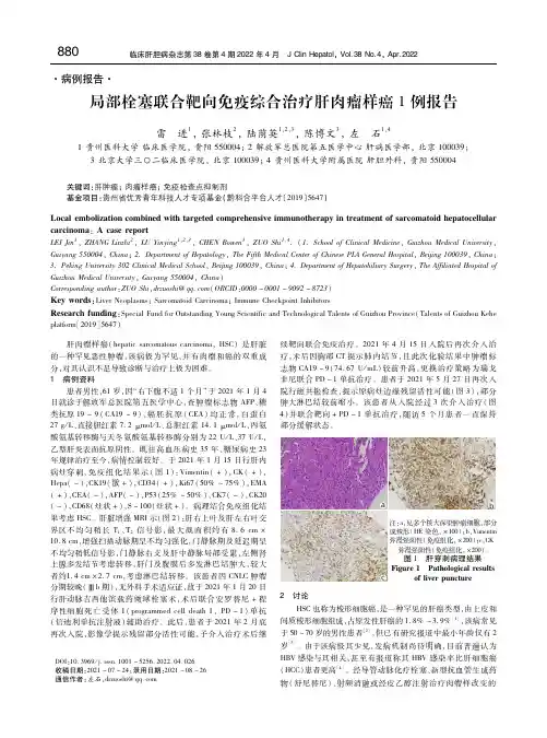 局部栓塞联合靶向免疫综合治疗肝肉瘤样癌1例报告