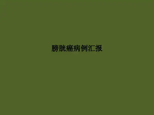 膀胱癌病例汇报