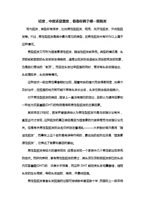 轻度,中度还是重度,看看你属于哪一级脱发