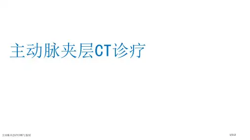 主动脉夹层CT诊断与鉴别