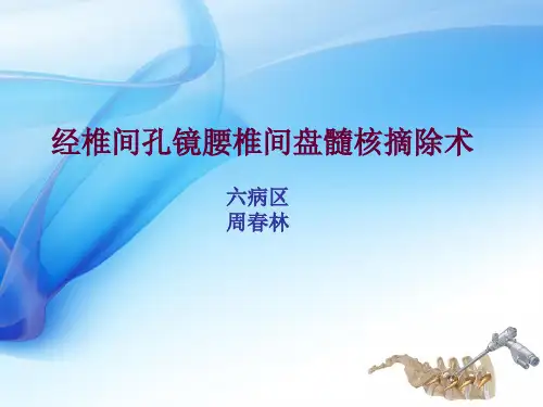 《椎间孔镜》ppt课件