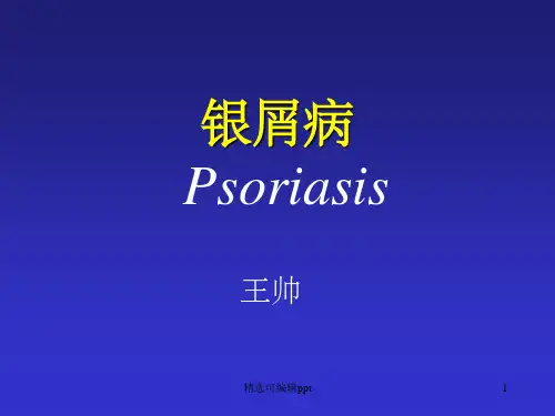 银屑病Psoriasis-PPT课件