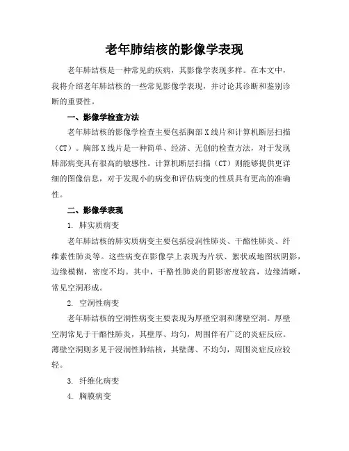 老年肺结核的影像学表现