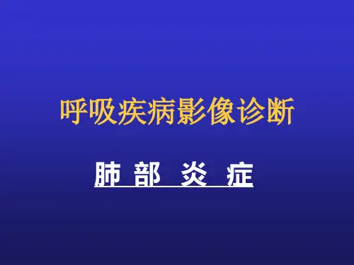 影像诊断学(肺炎)