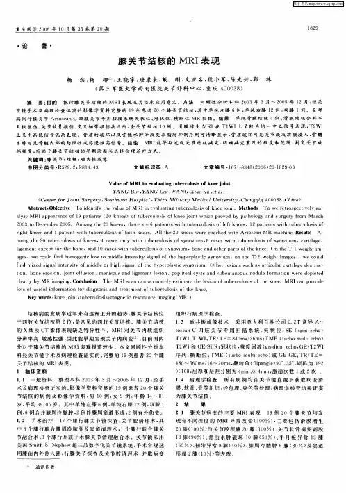 膝关节结核的MRI表现