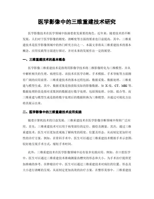 医学影像中的三维重建技术研究