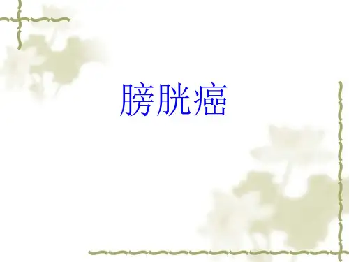 膀胱癌护理查房