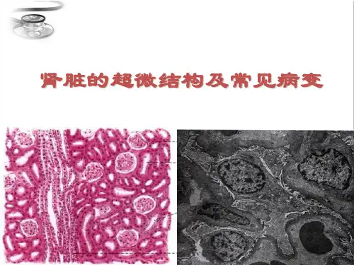 肾脏 ppt课件