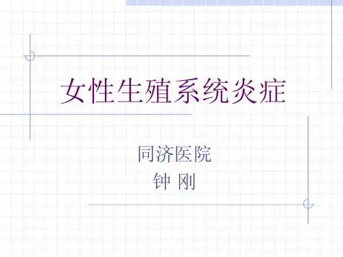 女性生子系统炎症：钟刚