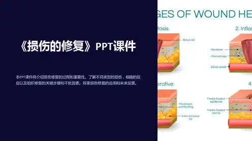 《损伤的修复》课件