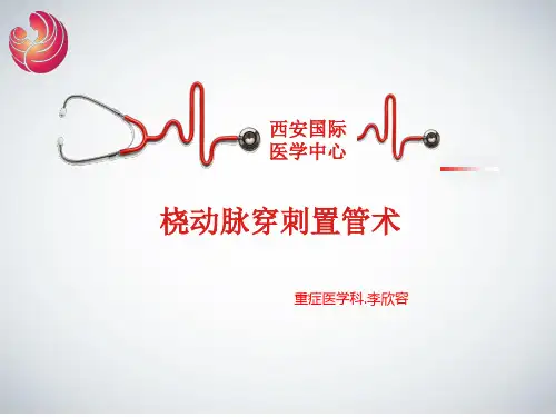 桡动脉穿刺置管术PPT课件