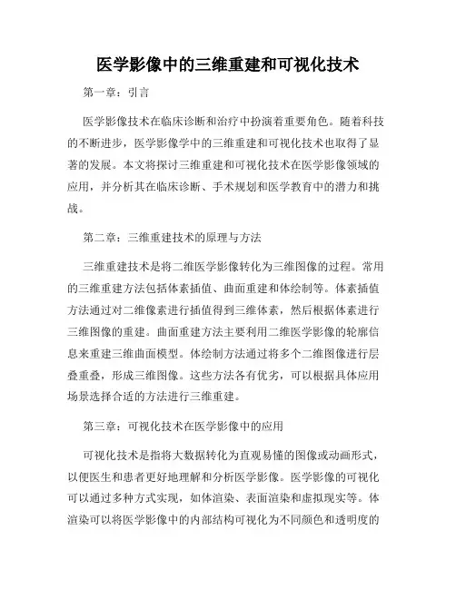 医学影像中的三维重建和可视化技术
