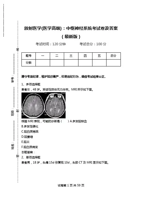 放射医学(医学高级)：中枢神经系统考试卷及答案(最新版).doc