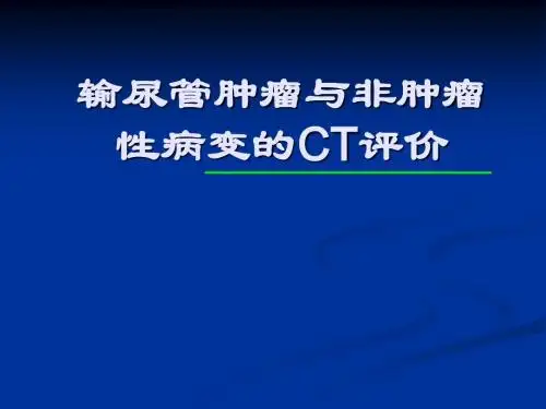 输尿管肿瘤与非肿瘤性病变的CT评价PPT课件
