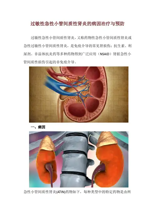 过敏性急性小管间质性肾炎的病因治疗与预防