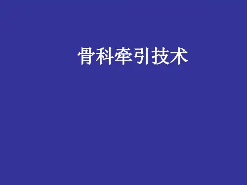 骨科牵引技术