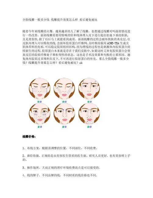 全脸线雕一般多少钱 线雕提升效果怎么样