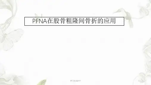 PFNA在股骨粗隆间骨折的应用ppt课件