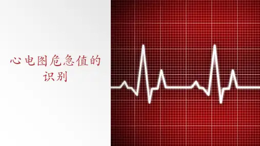 心电图危急值的识别