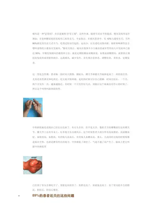 痛风是一种