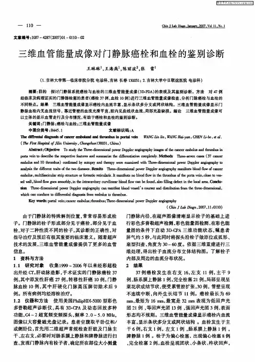 三维血管能量成像对门静脉癌栓和血栓的鉴别诊断