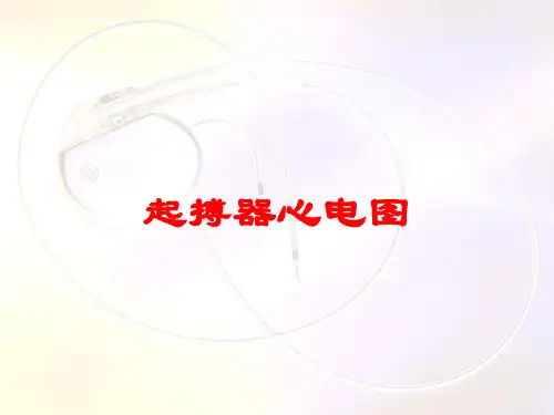 起搏器心电图培训课件