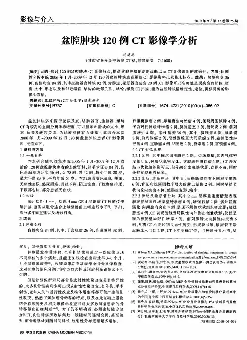 盆腔肿块120例CT影像学分析