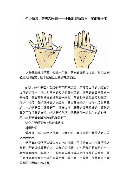 一个小指套，解决大问题——手指肌腱断裂不一定都要手术