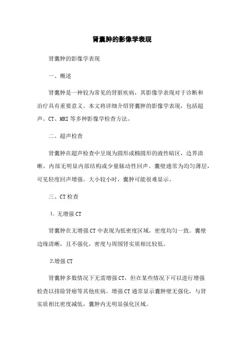 肾囊肿的影像学表现