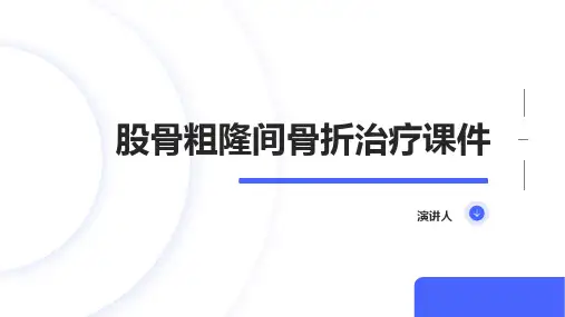 股骨粗隆间骨折治疗课件