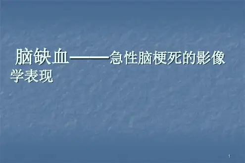 急性脑梗死的影像学表现ppt课件