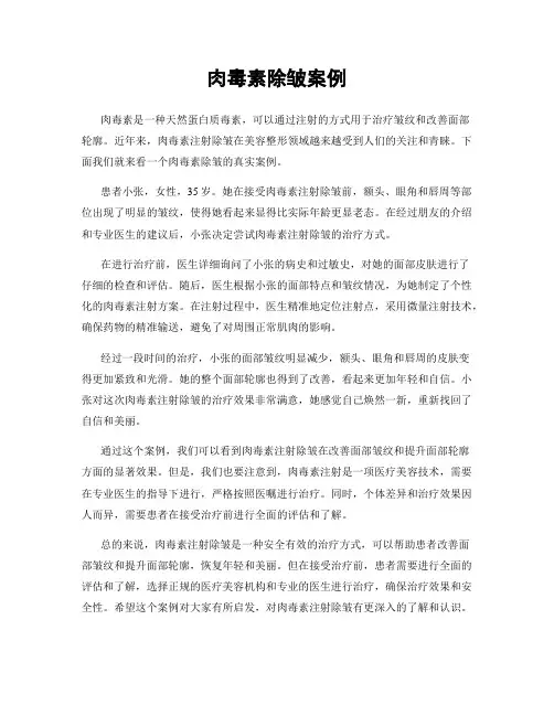 肉毒素除皱案例