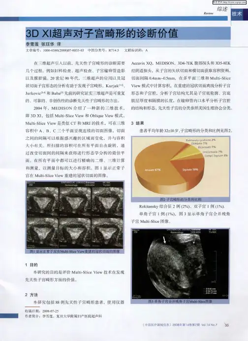 3D XI超声对子宫畸形的诊断价值