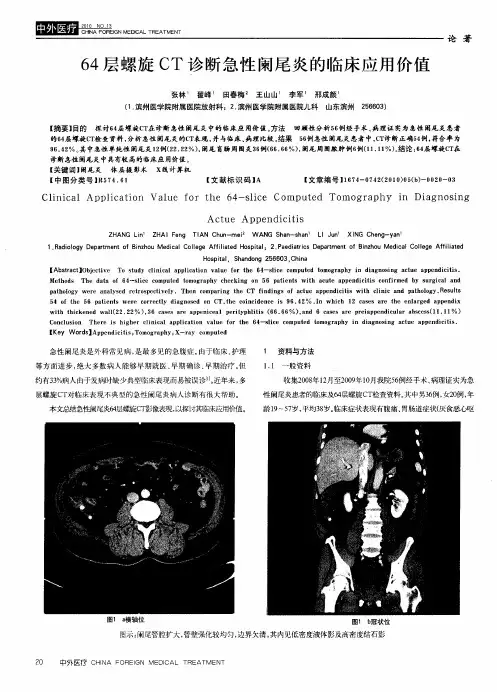 64层螺旋CT诊断急性阑尾炎的临床应用价值